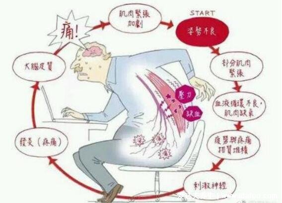 背部筋膜炎疼痛位置圖，身體背部各部位疼痛對比圖