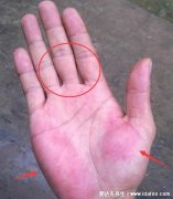 臉上出現蜘蛛痣肝病嚴重嗎(肝掌蜘蛛痣怎
