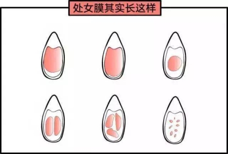 女性陰部真實照片：健康女人真實完美陰道及處女膜解剖學圖片【多圖】