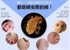 塵螨過敏打噴嚏(螨蟲咬后過敏圖片大全