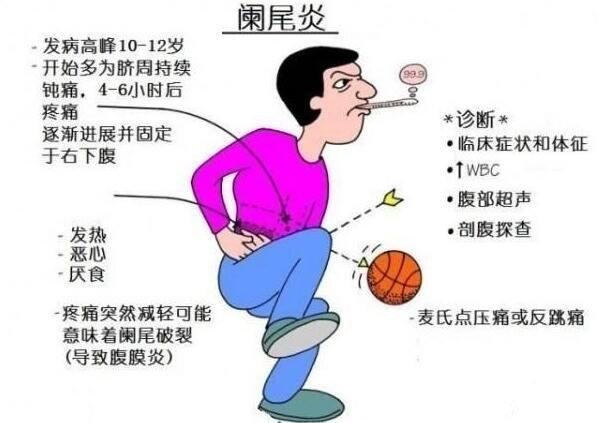 闌尾炎在左邊還是右邊疼痛位置圖片，右下腹肚臍周圍劇痛