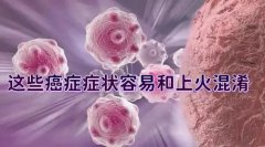 肋骨疼是癌癥早期信號(你以為你接受誰的