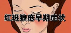 紅斑狼瘡最常見最嚴重的臨床表現(紅斑狼