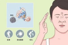 有一種眩暈叫耳石癥(如何判斷眩暈癥是不
