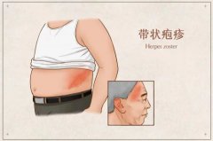 流行性感冒的高發季節(流行性感冒的高發季節為哪個季節)