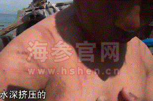 海參